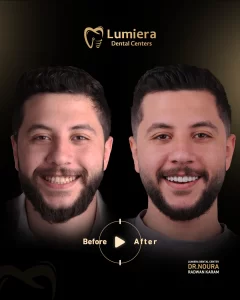 تجميل الاسنان