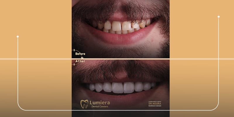 تجميل الاسنان